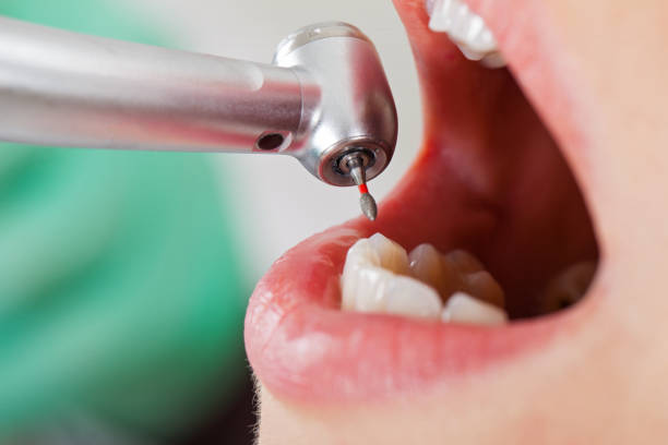 Best Walk-In Emergency Dental Services in Coldstream, OH